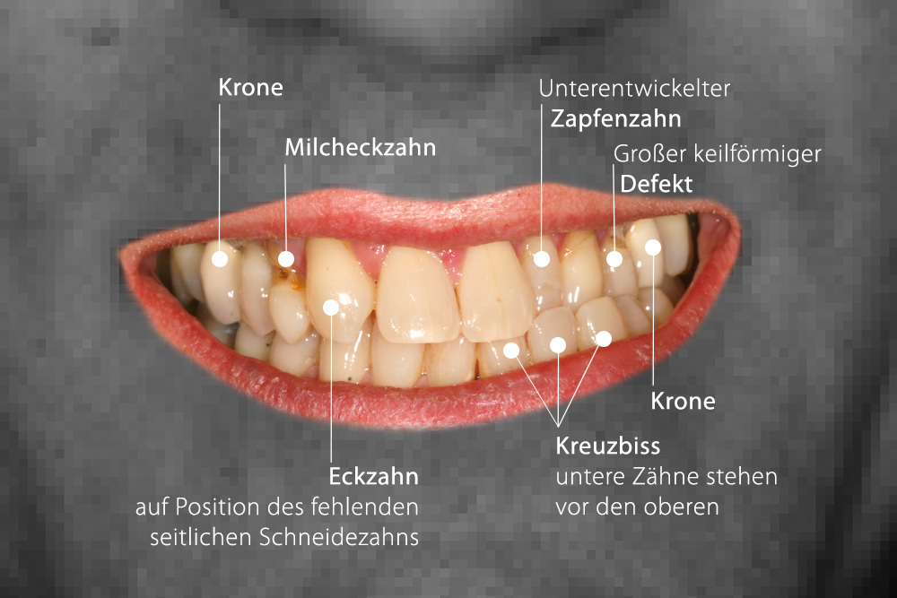 Gesamtkonzeptionelle Lösung für einen Komplexpatient