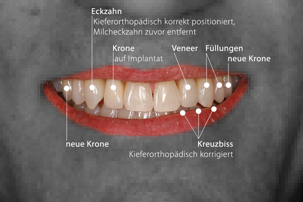 Gesamtkonzeptionelle Lösung für einen Komplexpatient